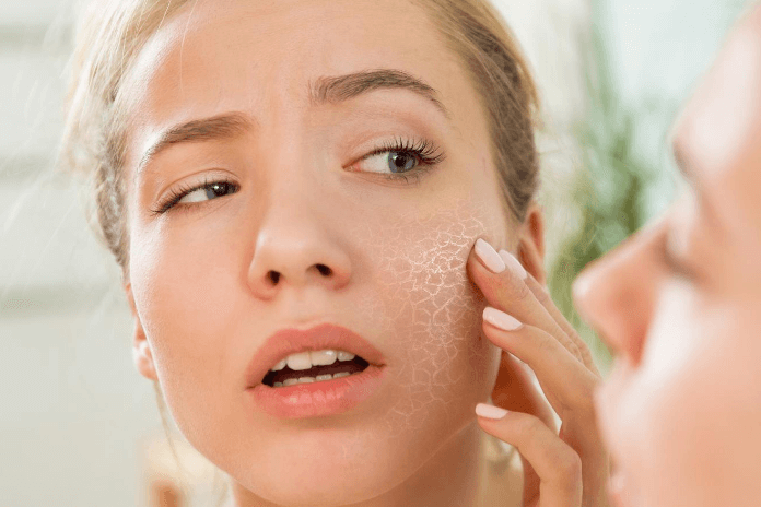 How To Deal With Dry Skin