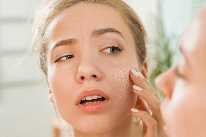 How To Fix Dry Skin