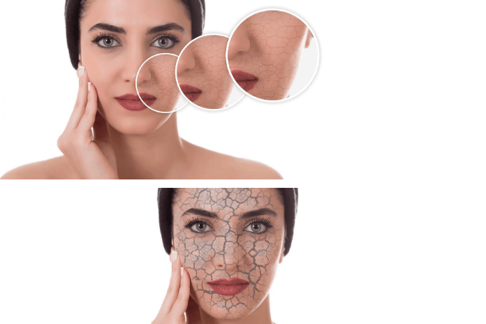 How To Remove Dry Skin From Face