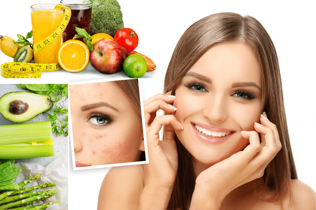 How diet affects skin positively?