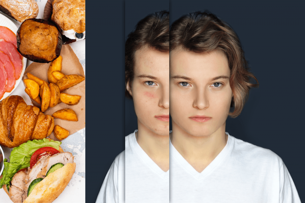 How diet affects skin negatively?