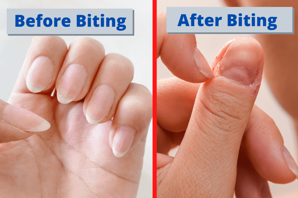 how to stop biting nails