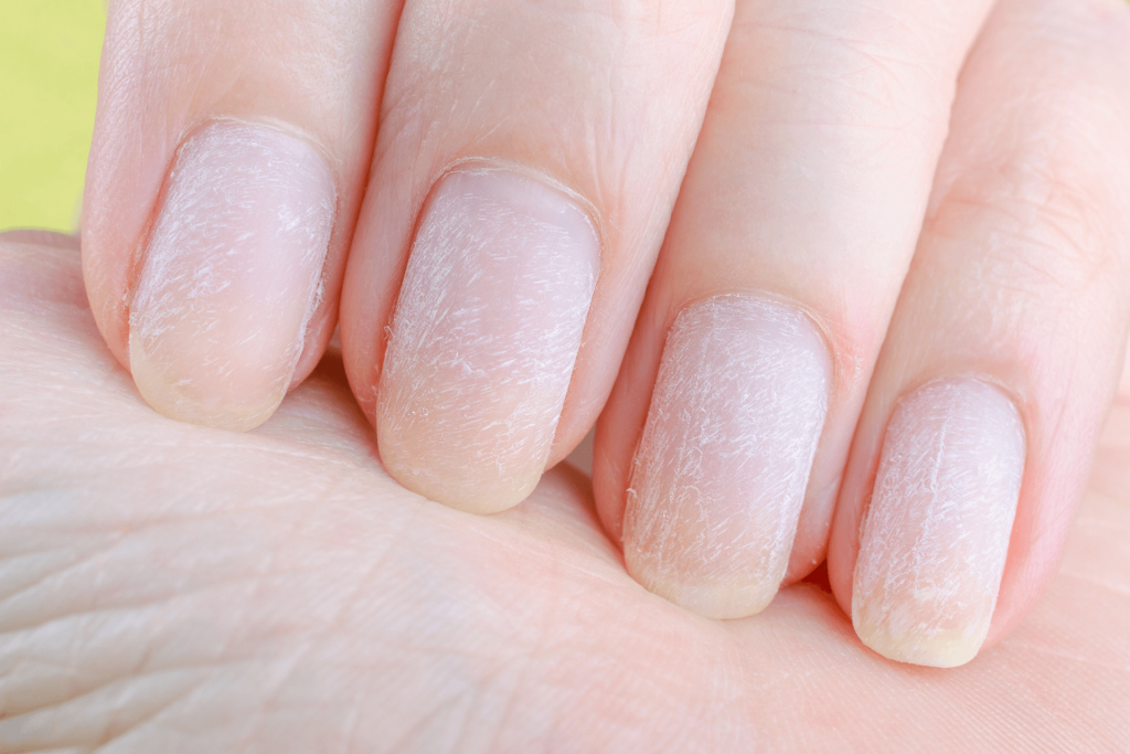How To Remove Gel Nails
