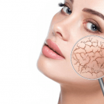 3 Quick Methods For How To Get Rid Of Dry Skin On Your Face How To Get Rid Of Dry Skin On Your Face