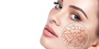 3 Quick Methods For How To Get Rid Of Dry Skin On Your Face How To Get Rid Of Dry Skin On Your Face