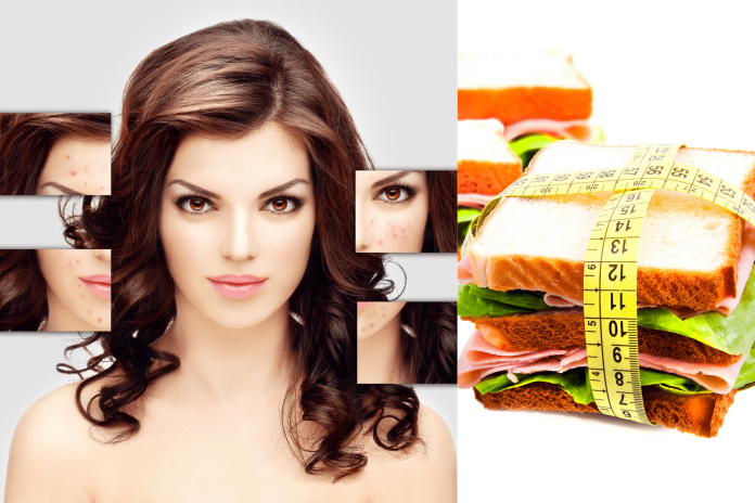 How Diet Affects Acne