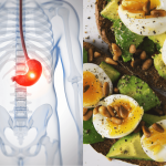 How Diet Affects Cancer: What Is The Connection? How Diet Affects Cancer