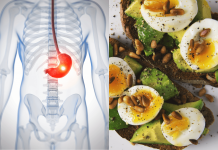 How Diet Affects Cancer: What Is The Connection? How Diet Affects Cancer