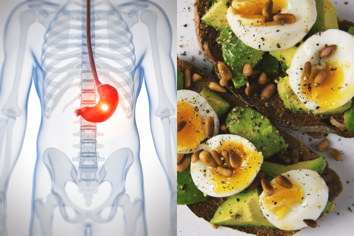 How Diet Affects Cancer