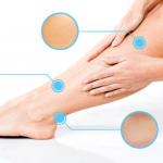 Top Methods On How To Cure Dry Skin On Legs How To Cure Dry Skin On Legs