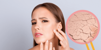 A Complete Guide On How To Deal With Dry Skin How To Deal With Dry Skin