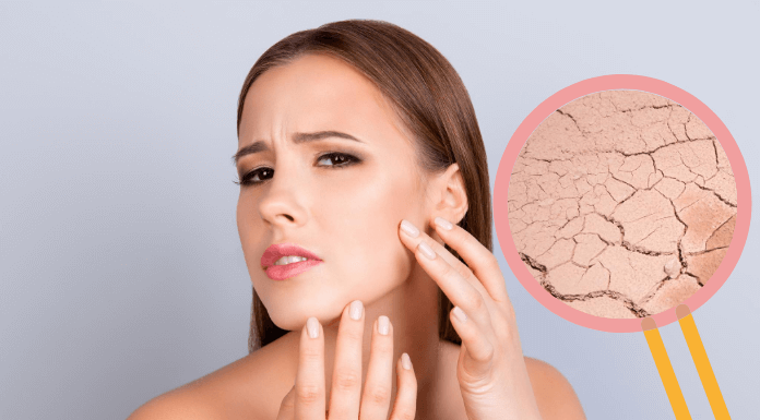 A Complete Guide On How To Deal With Dry Skin How To Deal With Dry Skin