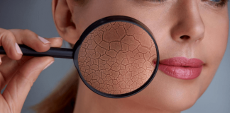 How To Fix Dry Skin: 7 Expert Tips For Relief How To Fix Dry Skin