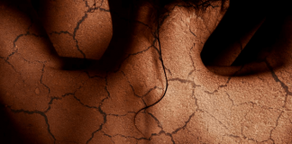 How To Treat Dry Skin In 8 Simple Steps But Most Effective How To Treat Dry Skin