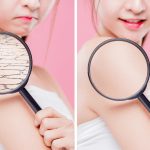 5 Ways Of How To Get Rid Of Dry Skin Completely How to Get Rid of Dry Skin