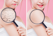 5 Ways Of How To Get Rid Of Dry Skin Completely How to Get Rid of Dry Skin