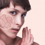12 Reasons That Can Answer Your Question What Causes Dry Skin What Causes Dry Skin