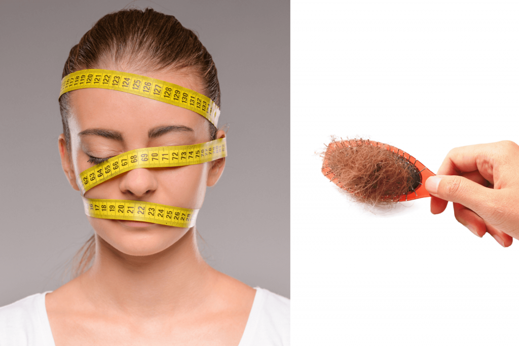 Can Diet Cause Hair Loss And What Can You Do About It?