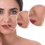 8 Golden Rules of How To Treat Your Dry Skin on Face How to treat your dry skin on face