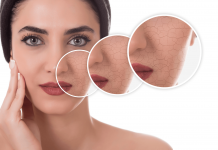 8 Golden Rules of How To Treat Your Dry Skin on Face How to treat your dry skin on face