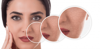 8 Golden Rules of How To Treat Your Dry Skin on Face How to treat your dry skin on face