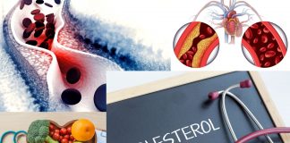 How To Reduce Cholesterol Naturally With 7 Easy Steps How To Reduce Cholesterol