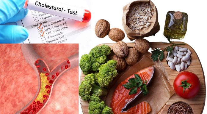 Low Cholesterol Diet Tips: The Proper Way To Control Your Cholesterol Low Cholesterol Diet