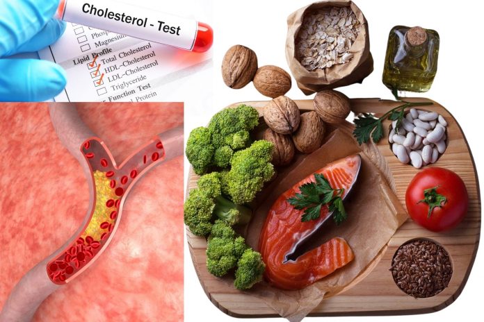 Low Cholesterol Diet